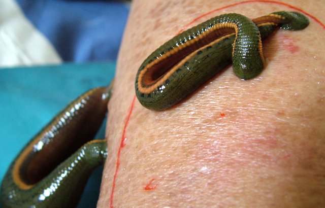 leeches on wounds